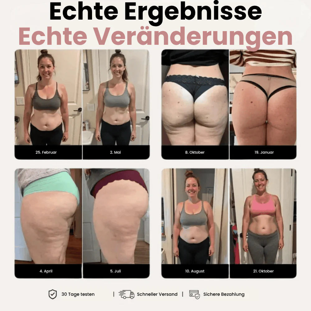 Cellumove 3D Legging – Definieren Sie Ihre Silhouette mühelos neu